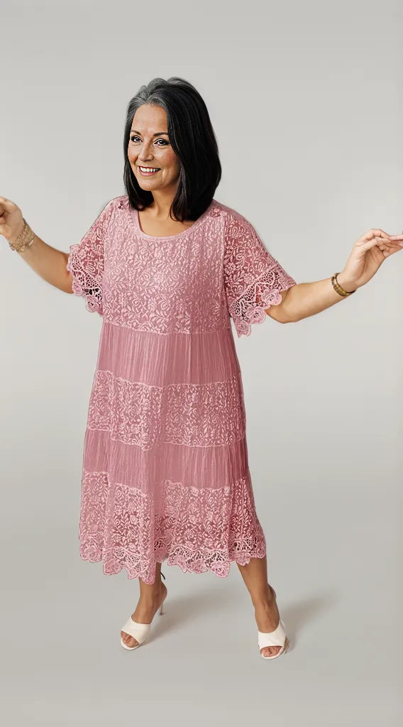 Alice | Casual Lace Dress